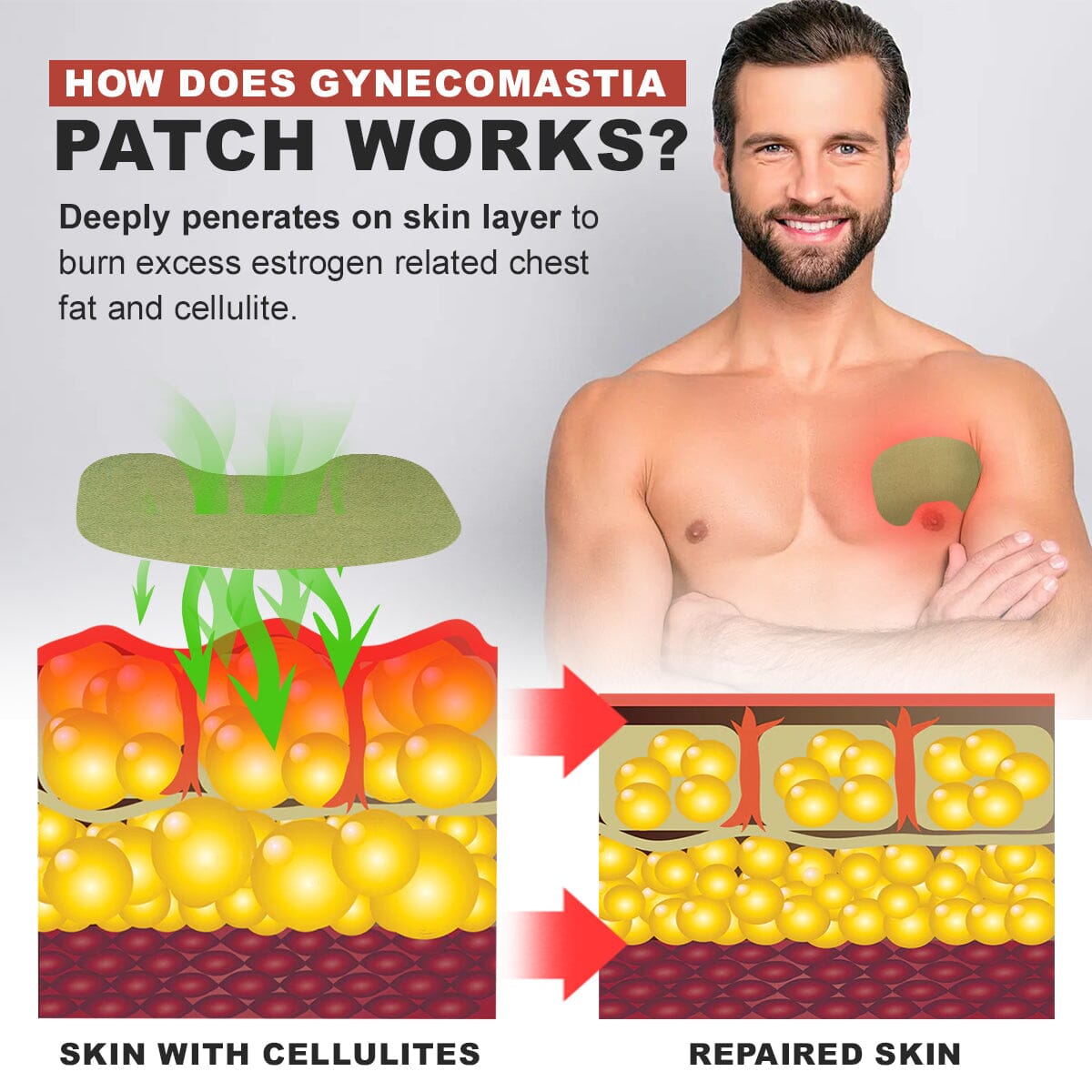 Luhaka™ Gynecomastia Cellulite Melting Patch